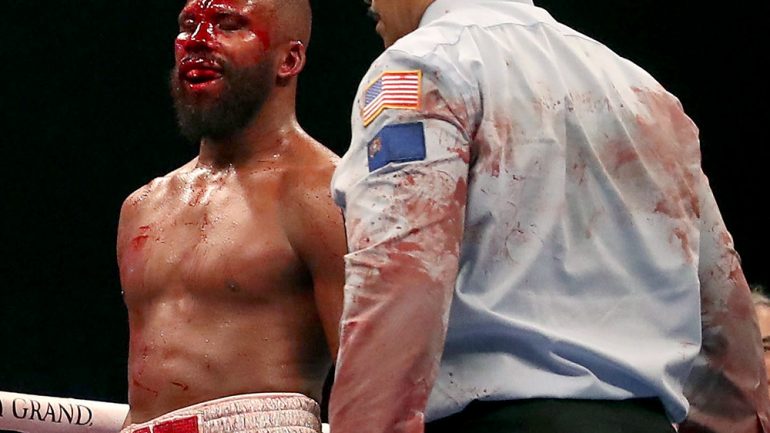Bloody shirt from Marcus Browne-Badou Jack fight could wind up in the Hall of Fame