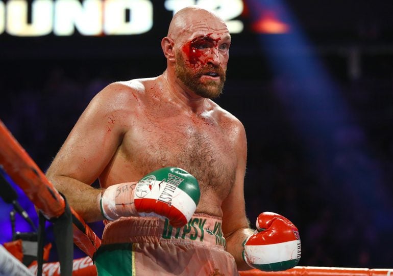 Tyson Fury survives severe to decision Otto - The Ring