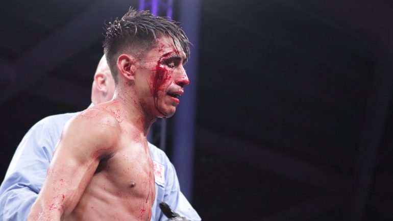 Bloodied Daniel Valladares wins split decision over Rene Mark Cuarto, claims IBF strawweight belt